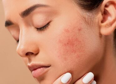 skin